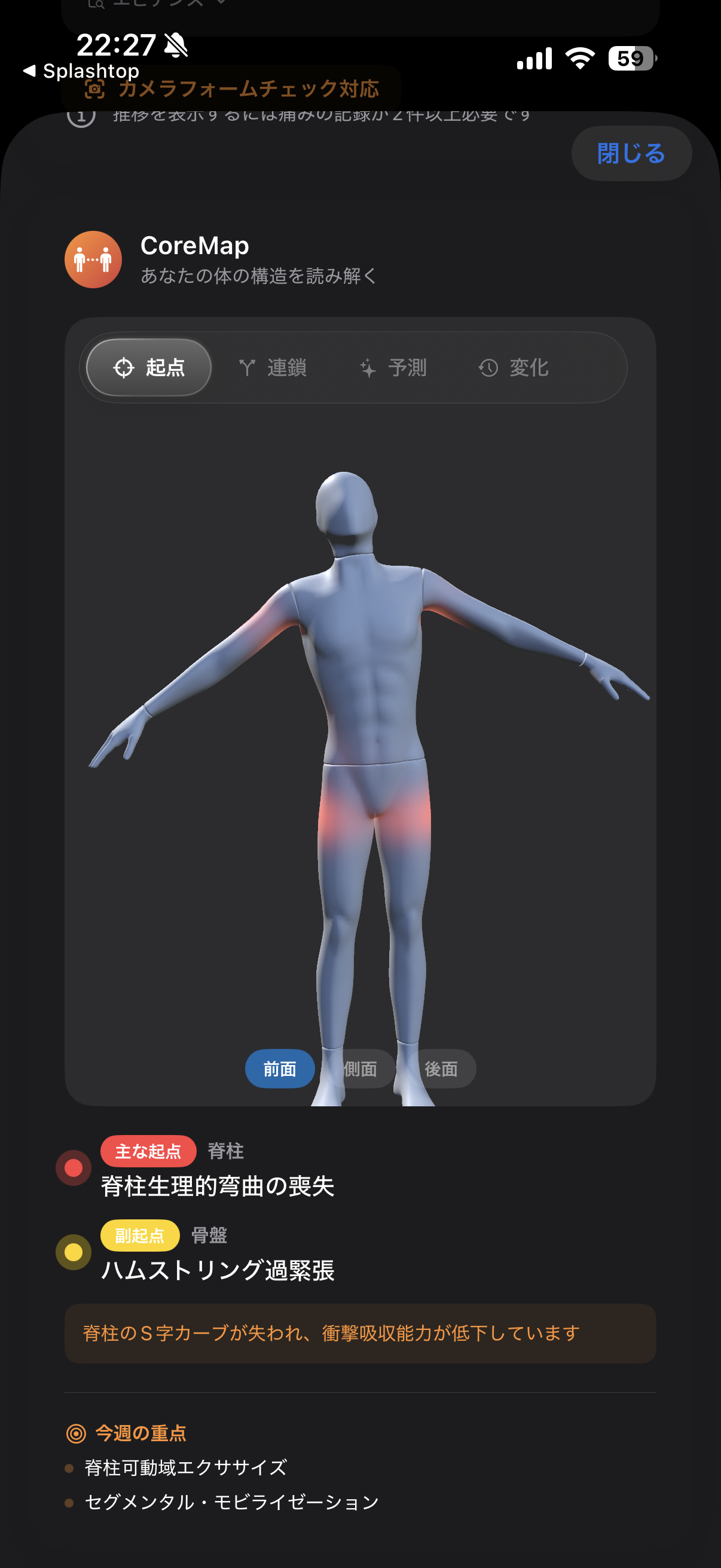 CorePose 3D body map analysis