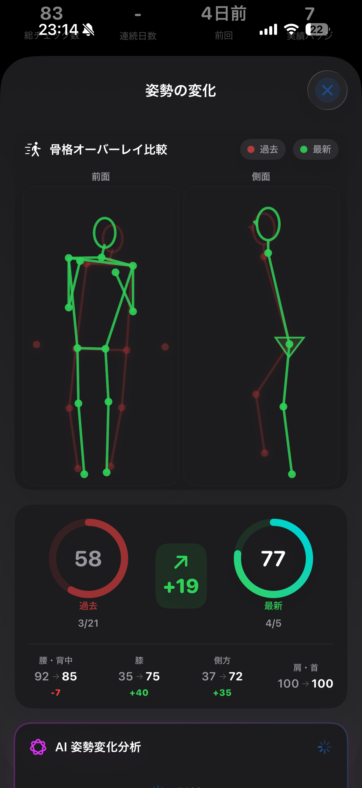 CorePose posture comparison with skeletal overlay